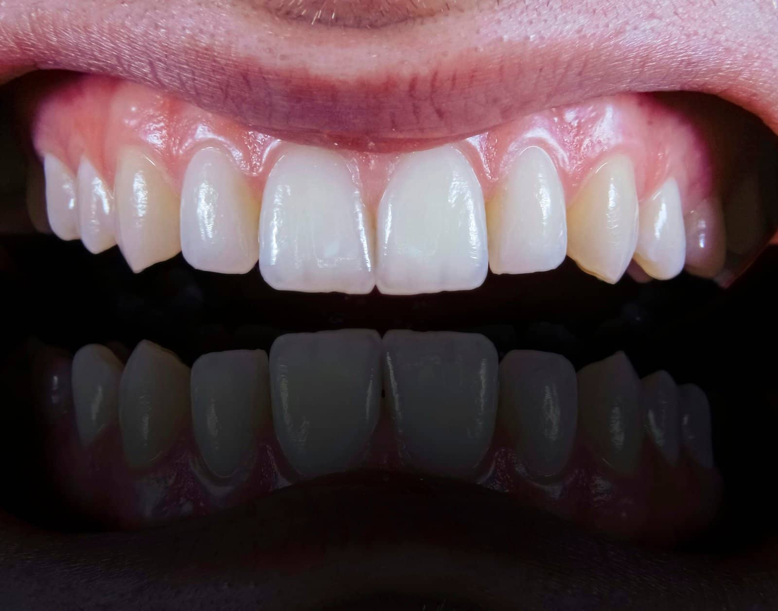 Oral Health and Heart Disease: Shocking New Studies You Should Know